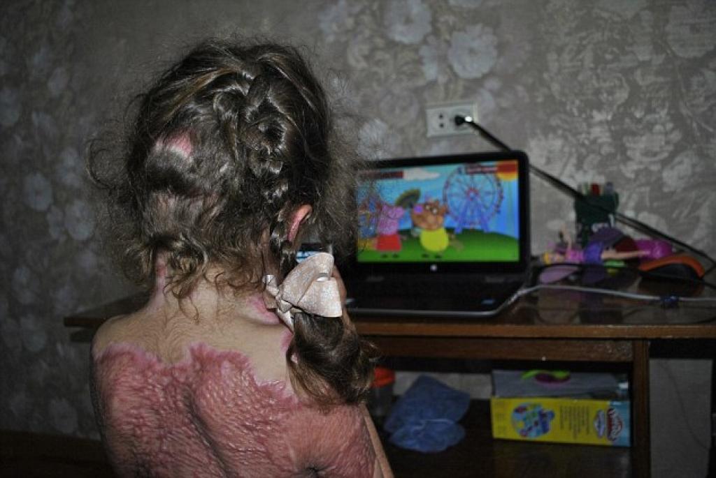 Plusieurs enfants sont victimes d'un terrible “jeu” qui sévit sur la toile...les conséquences sont désastreuses 1